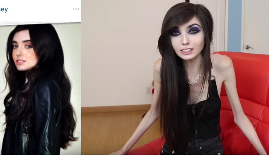 Caption: Eugenia-before and after. 